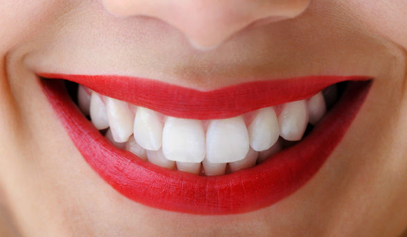 Teeth Whitening Special in Melbourne